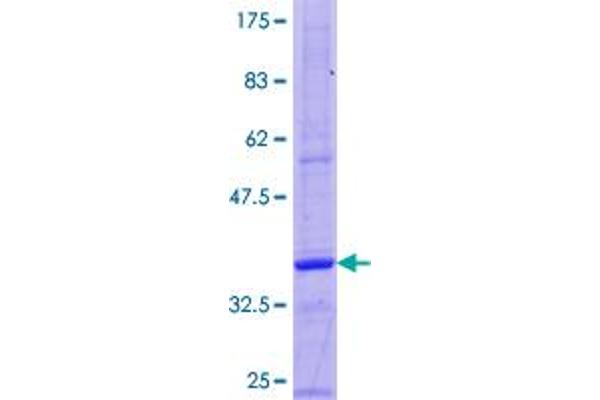 Gastrin Protein (GAST) (AA 1-101) (GST tag)