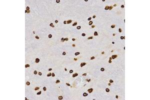 Immunohistochemistry of paraffin-embedded rat brain tissue using H4K20me2 antibody at dilution of 1:200 (x400 lens).