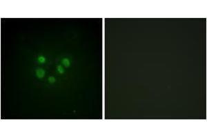 Immunofluorescence analysis of A549 cells, using Bloom Syndrome (Ab-99) Antibody. (Bloom Syndrome (AA 65-114) 抗体)