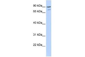 AKAP8 antibody used at 0. (AKAP8 抗体  (Middle Region))