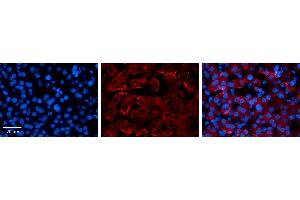 CTAGE5 antibody - middle region          Formalin Fixed Paraffin Embedded Tissue:  Human Liver Tissue    Observed Staining:  Membrane in hepatocytes   Primary Antibody Concentration:  1:100    Secondary Antibody:  Donkey anti-Rabbit-Cy3    Secondary Antibody Concentration:  1:200    Magnification:  20X    Exposure Time:  0. (MIA2 抗体  (Middle Region))