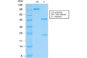 SDS-PAGE Analysis Purified SOX9 Recombinant Rabbit Monoclonal Antibody (SOX9/2287R). (Recombinant SOX9 抗体)