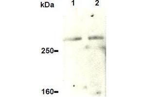Western Blotting (WB) image for anti-Ataxia Telangiectasia and Rad3 Related (ATR) antibody (ABIN1449281) (ATR 抗体)
