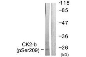 Western blot analysis of extracts from HuvEc cells, using CKII-beta (Phospho-Ser209) Antibody. (CSNK2B 抗体  (pSer209))