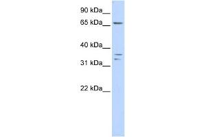 WB Suggested Anti-IQCE Antibody Titration: 0. (IQCE 抗体  (Middle Region))