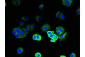 Immunofluorescent analysis of MCF-7 cells using ABIN7171285 at dilution of 1:100 and Alexa Fluor 488-congugated AffiniPure Goat Anti-Rabbit IgG(H+L) (TRBC1 抗体  (AA 1-176))