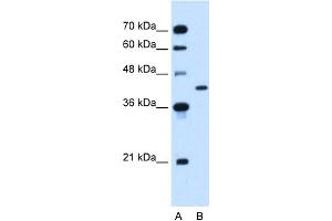 WB Suggested Anti-GOT2 Antibody Titration:  1. (GOT2 抗体  (N-Term))