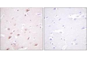 Immunohistochemistry analysis of paraffin-embedded human brain, using CKII-beta (Phospho-Ser209) Antibody. (CSNK2B 抗体  (pSer209))