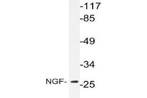 Western blot analysis of NGF Antibody in extracts from Jurkat cells. (Nerve Growth Factor 抗体)
