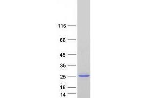 Western Blotting (WB) image for Ubiquitin-Conjugating Enzyme E2C (UBE2C) (Transcript Variant 5) protein (Myc-DYKDDDDK Tag) (ABIN2734895)