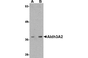 Western Blotting (WB) image for anti-Aldehyde Dehydrogenase 3 Family, Member A2 (ALDH3A2) (C-Term) antibody (ABIN1030231) (ALDH3A2 抗体  (C-Term))