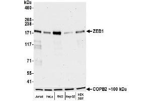 Western Blotting (WB) image for anti-Zinc Finger E-Box Binding Homeobox 1 (ZEB1) (AA 750-800) antibody (ABIN7455173) (Recombinant ZEB1 抗体  (AA 750-800))