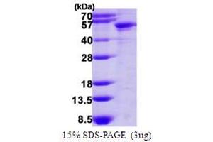 SDS-PAGE (SDS) image for Keratin 14 (KRT14) (AA 1-472) protein (His tag) (ABIN667956)