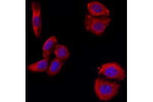ABIN6263291 and ABIN6266590 staining Hela by IF/ICC. (MMP11 抗体  (N-Term))