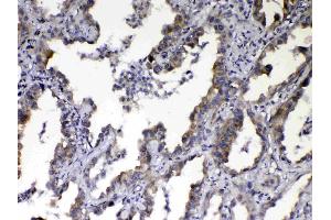 IHC analysis of NOV/CCN3 using anti-NOV/CCN3 antibody . (NOV 抗体  (C-Term))