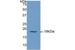 Detection of Recombinant SELP, Human using Polyclonal Antibody to P-Selectin (SELP) (P-Selectin 抗体  (AA 58-195))