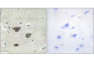 Immunohistochemistry analysis of paraffin-embedded human brain tissue, using CDH8 Antibody. (Cadherin 8 抗体  (AA 491-540))