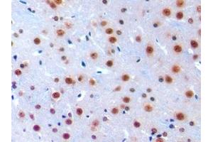 Detection of IRF1 in Mouse Cerebrum Tissue using Polyclonal Antibody to Interferon Regulatory Factor 1 (IRF1) (IRF1 抗体  (AA 44-319))