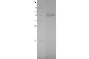 Western Blotting (WB) image for Mitogen-Activated Protein Kinase 11 (MAPK11) (AA 1-364) protein (His tag) (ABIN7123990) (MAPK11 Protein (AA 1-364) (His tag))