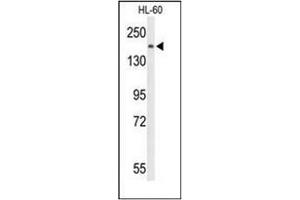 Western blot analysis of PLCB1 Antibody (C-term) in HL-60 cell line lysates (35ug/lane). (Phospholipase C beta 1 抗体  (C-Term))