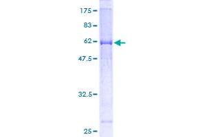 MUL1 Protein (AA 1-352) (GST tag)