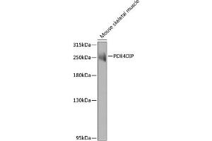 Western blot analysis of extracts of mouse skeletal muscle, using PDE4DIP antibody (ABIN6132801, ABIN6145357, ABIN6145358 and ABIN6223715) at 1:1000 dilution. (PDE4DIP 抗体  (AA 1-310))