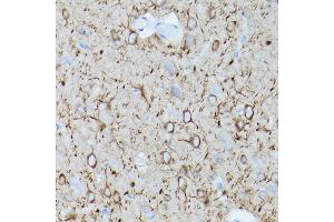 Immunohistochemistry of paraffin-embedded mouse brain using α-Tubulin Mouse mAb (ABIN7271035) at dilution of 1:100 (40x lens). (TUBA4A 抗体)