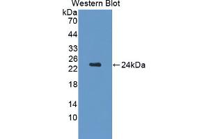 Western blot analysis of the recombinant protein. (CDNF 抗体  (AA 20-183))