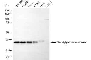 Western blotting analysis using N-acetylglucosamine kinase antibody (ABIN7799530). (NAGK 抗体)