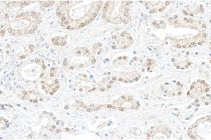 anti-Block of Proliferation 1 (BOP1) (AA 350-400) antibody