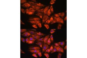 Immunofluorescence (IF) image for anti-Protein Phosphatase 1, Regulatory (Inhibitor) Subunit 15A (PPP1R15A) (AA 375-674) antibody (ABIN7269676)