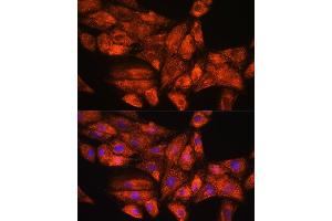 Immunofluorescence analysis of H9C2 cells using PPP1R15A Rabbit pAb (ABIN7269676) at dilution of 1:100. (GADD34 抗体  (AA 375-674))