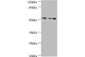 Western blot All lanes: Neuronal acetylcholine receptor subunit alpha-5 antibody at 12 μg/mL Lane 1: Jurkat whole cell lysate Lane 2: A431 whole cell lysate Lane 3: A549 whole cell lysate Secondary Goat polyclonal to rabbit IgG at 1/10000 dilution Predicted band size: 53 kDa Observed band size: 53 kDa