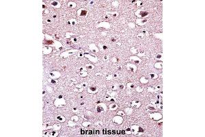 Immunohistochemistry (IHC) image for anti-Parkinson Protein 2, E3 Ubiquitin Protein Ligase (Parkin) (PARK2) antibody (ABIN3002635) (Parkin 抗体)