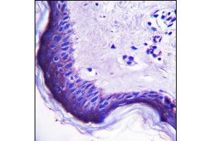 Immunohistochemistry (Paraffin-embedded Sections) (IHC (p)) image for anti-Endogenous Retrovirus Group 3, Member 1 (ERV3-1) (AA 445-474), (C-Term) antibody (ABIN657358)