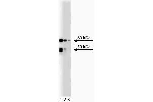 Western blot anakysis of Chk2 on RSV-3T3 lysate. (CHEK2 抗体  (AA 31-234))