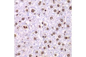 Immunohistochemistry of paraffin-embedded mouse liver using SSRP1 antibody at dilution of 1:200 (400x lens). (SSRP1 抗体)