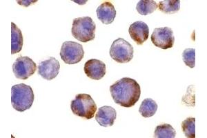 Immunohistochemistry (IHC) image for anti-ADAM Metallopeptidase Domain 17 (ADAM17) (C-Term) antibody (ABIN1030720) (ADAM17 抗体  (C-Term))