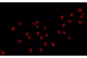 ABIN6266717 staining 293 by IF/ICC. (DLX3 抗体  (Internal Region))