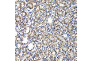Immunohistochemistry of paraffin-embedded rat kidney using COPS2 antibody (ABIN6130123, ABIN6138877, ABIN6138878 and ABIN6222819) at dilution of 1:100 (40x lens). (COPS2 抗体  (AA 1-310))
