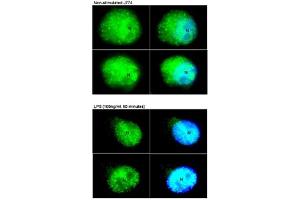 Immunohistochemistry (IHC) image for anti-Signal Transducer and Activator of Transcription 3 (Acute-Phase Response Factor) (STAT3) (N-Term) antibody (ABIN2780479)