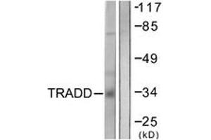 Western blot analysis of extracts from COS7 cells, using TRADD Antibody.