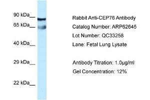 Western Blotting (WB) image for anti-Centrosomal Protein 76kDa (Cep76) (Middle Region) antibody (ABIN2789198)