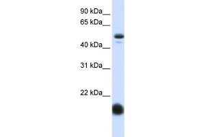 WB Suggested Anti-SLC22A7 Antibody Titration:  0. (SLC22A7 抗体  (N-Term))