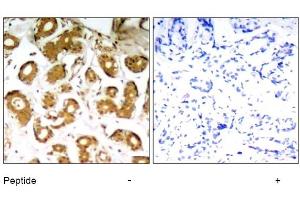 Image no. 1 for anti-Nuclear Factor-kB p65 (NFkBP65) (Thr505) antibody (ABIN319321) (NF-kB p65 抗体  (Thr505))