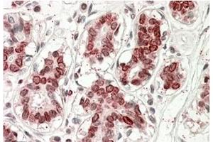 AP32140PU-N STS2 / TULA antibody staining of paraffin embedded Human Breast at 3. (UBASH3A 抗体  (Internal Region))