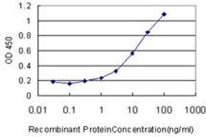 Detection limit for recombinant GST tagged CA12 is approximately 1ng/ml as a capture antibody. (CA12 抗体  (AA 25-124))