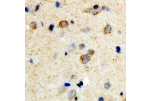 Immunohistochemical analysis of mPR gamma staining in human brain formalin fixed paraffin embedded tissue section. (PAQR5 抗体  (C-Term))