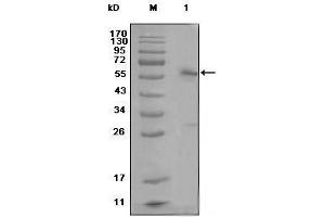 Western blot analysis using ESR1 mouse mAb against MCF-7 cell lysate (1)