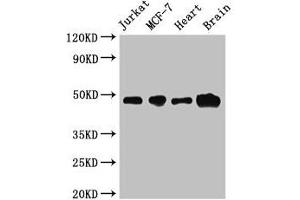 Western Blot Positive WB detected in: Jurkat whole cell lysate, MCF-7 whole cell lysate, Mouse heart tissue, Mouse brain tissue All lanes: ZNF645 antibody at 3. (ZNF645 抗体  (AA 200-413))